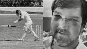 Malcolm Marshall broke Mike Gatting's nose Bouncer.png